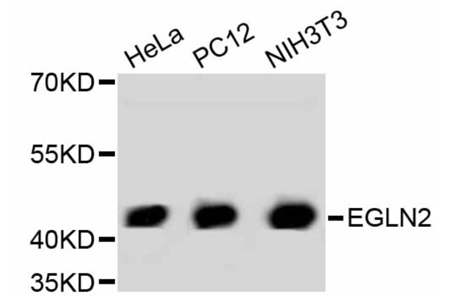Western Blot - Anti-EGLN2 Antibody (A11437) - Antibodies.com