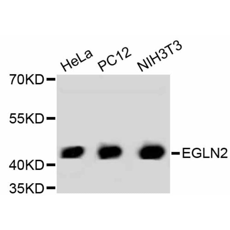 Western Blot - Anti-EGLN2 Antibody (A11437) - Antibodies.com