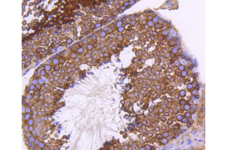 Immunohistochemistry - Anti-EGLN2 Antibody (A11437) - Antibodies.com