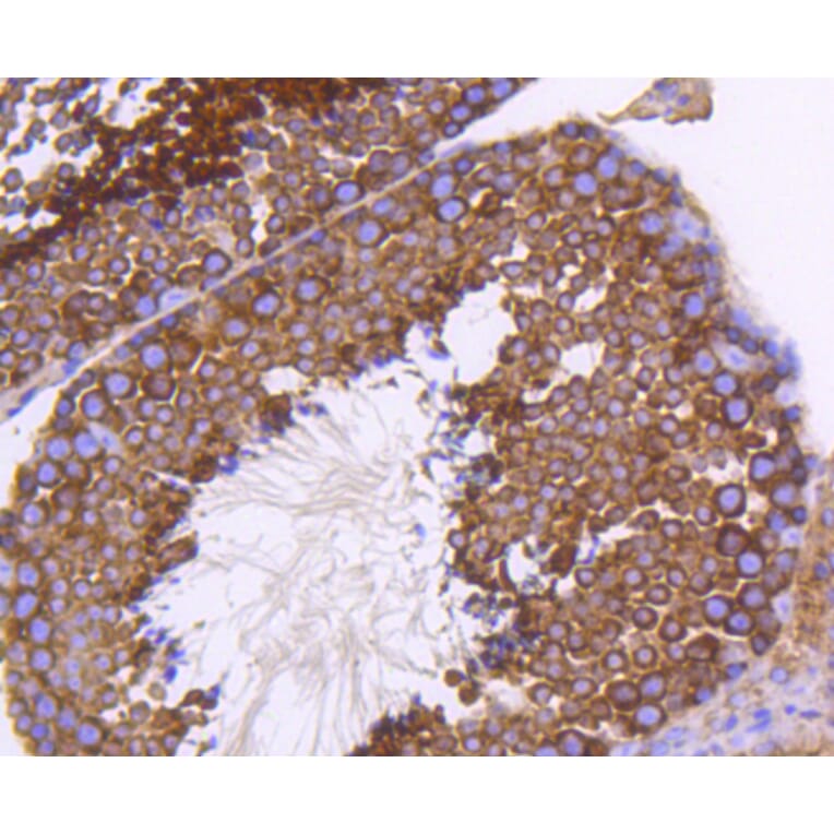 Immunohistochemistry - Anti-EGLN2 Antibody (A11437) - Antibodies.com