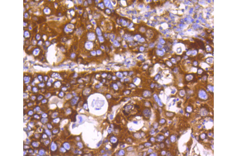 Immunohistochemistry - Anti-EGLN2 Antibody (A11437) - Antibodies.com