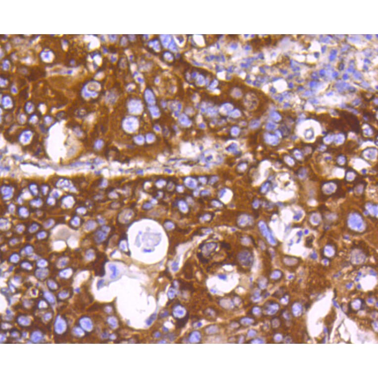 Immunohistochemistry - Anti-EGLN2 Antibody (A11437) - Antibodies.com
