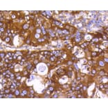 Immunohistochemistry - Anti-EGLN2 Antibody (A11437) - Antibodies.com