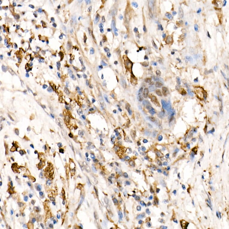 Immunohistochemistry - Anti-Ferritin Heavy Chain Antibody (A13317) - Antibodies.com