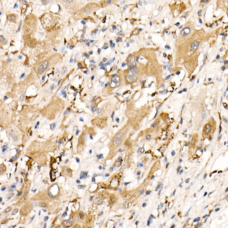 Immunohistochemistry - Anti-Ferritin Heavy Chain Antibody (A13317) - Antibodies.com