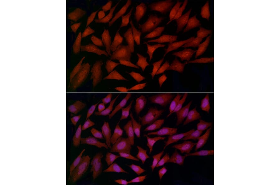 Immunofluorescence - Anti-Ferritin Heavy Chain Antibody (A13317) - Antibodies.com