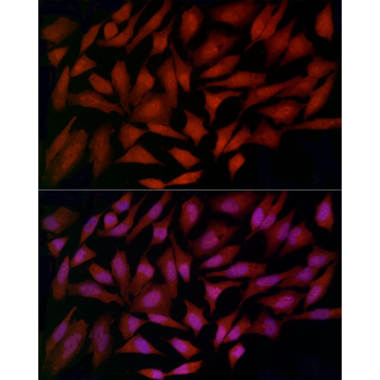 Immunofluorescence - Anti-Ferritin Heavy Chain Antibody (A13317) - Antibodies.com