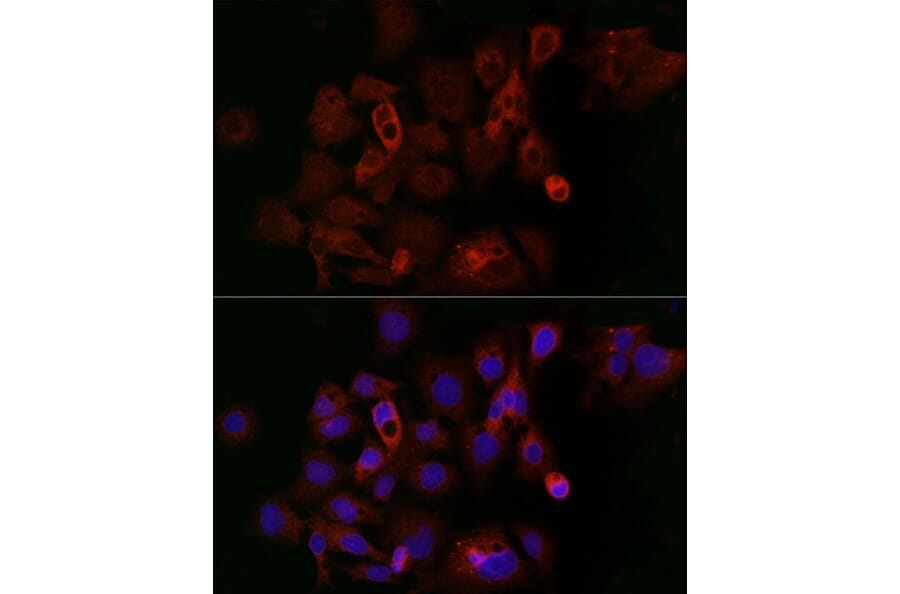 Immunofluorescence - Anti-Ferritin Heavy Chain Antibody (A13317) - Antibodies.com
