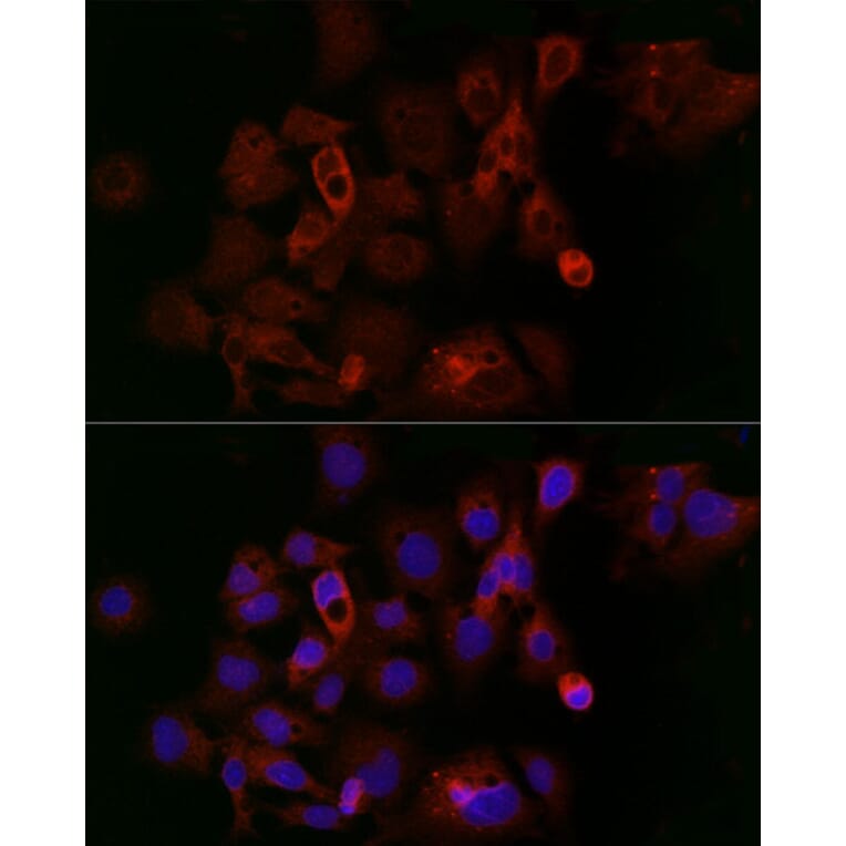 Immunofluorescence - Anti-Ferritin Heavy Chain Antibody (A13317) - Antibodies.com