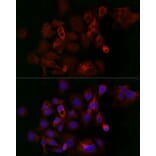 Immunofluorescence - Anti-Ferritin Heavy Chain Antibody (A13317) - Antibodies.com