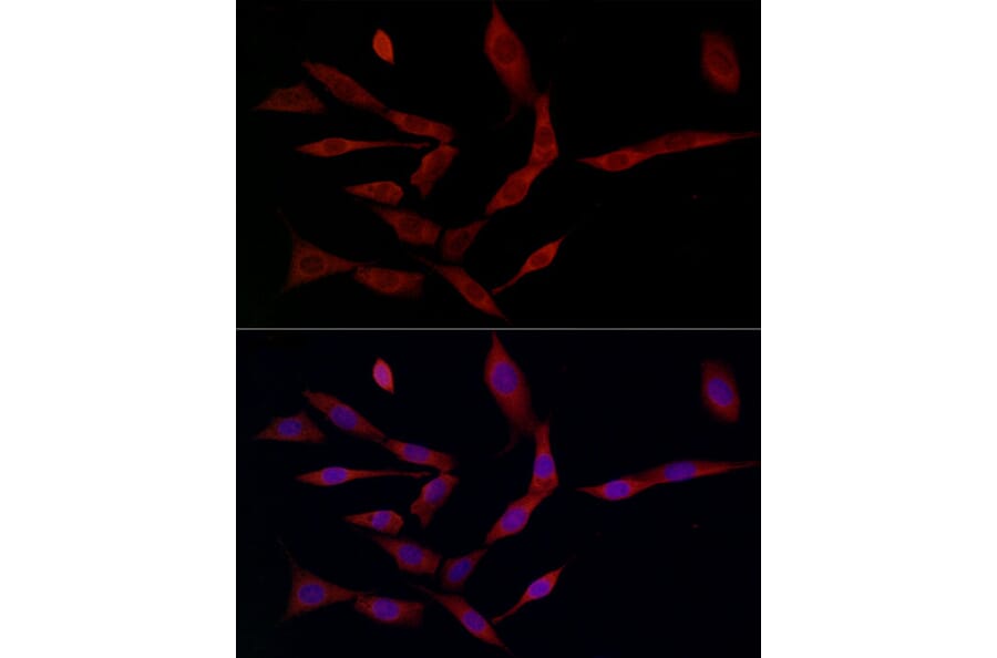 Immunofluorescence - Anti-Ferritin Heavy Chain Antibody (A13317) - Antibodies.com