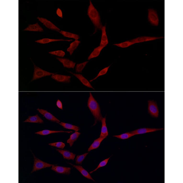Immunofluorescence - Anti-Ferritin Heavy Chain Antibody (A13317) - Antibodies.com
