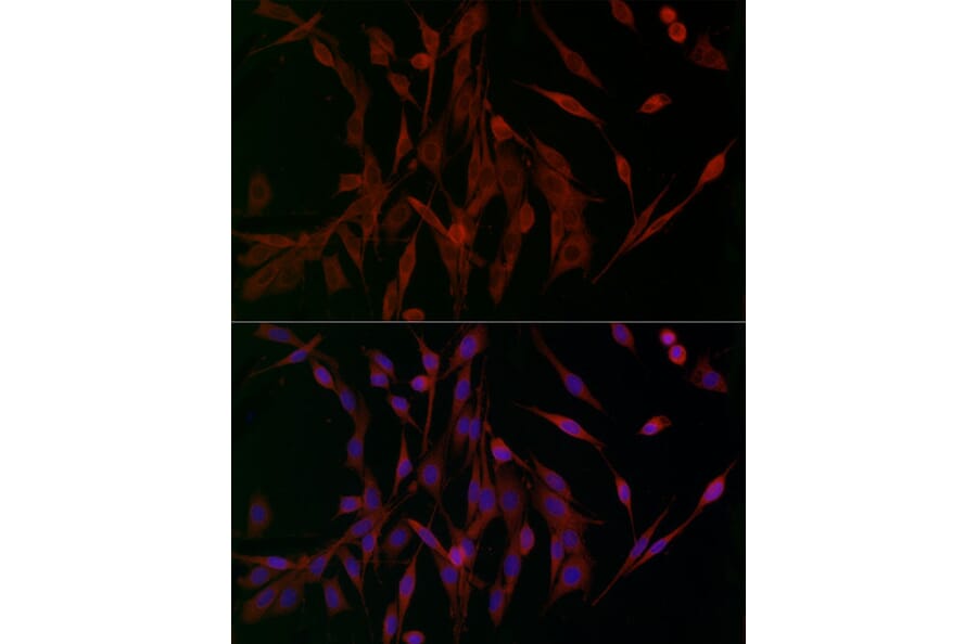 Immunofluorescence - Anti-Ferritin Heavy Chain Antibody (A13317) - Antibodies.com