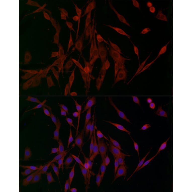 Immunofluorescence - Anti-Ferritin Heavy Chain Antibody (A13317) - Antibodies.com
