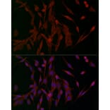 Immunofluorescence - Anti-Ferritin Heavy Chain Antibody (A13317) - Antibodies.com