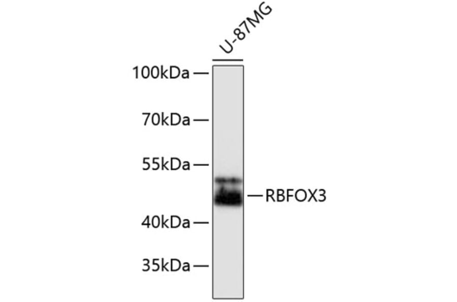 Western Blot - Anti-RBFOX3 Antibody (A11449) - Antibodies.com