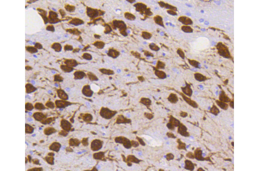 Immunohistochemistry - Anti-RBFOX3 Antibody (A11449) - Antibodies.com
