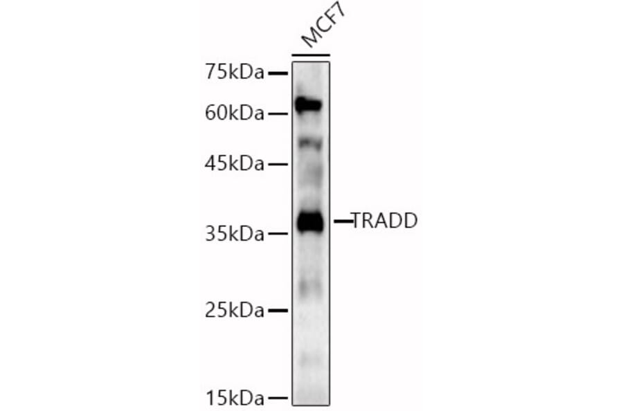 Western Blot - Anti-TRADD Antibody (A13319) - Antibodies.com
