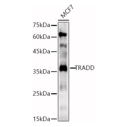 Western Blot - Anti-TRADD Antibody (A13319) - Antibodies.com