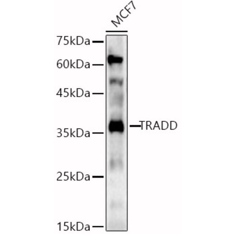 Western Blot - Anti-TRADD Antibody (A13319) - Antibodies.com
