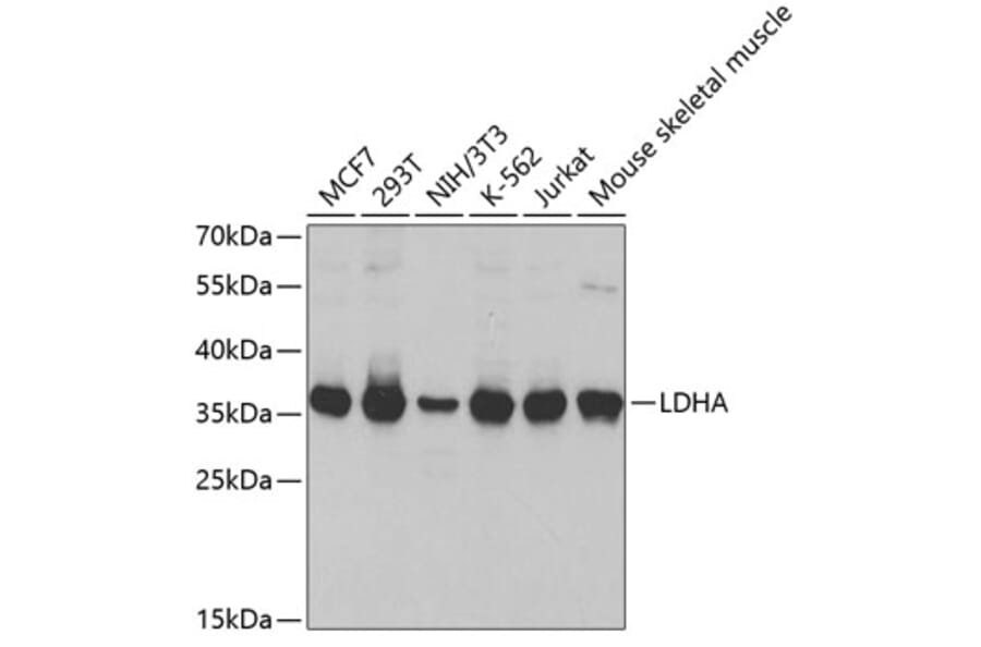 Western Blot - Anti-LDHA Antibody (A1146) - Antibodies.com