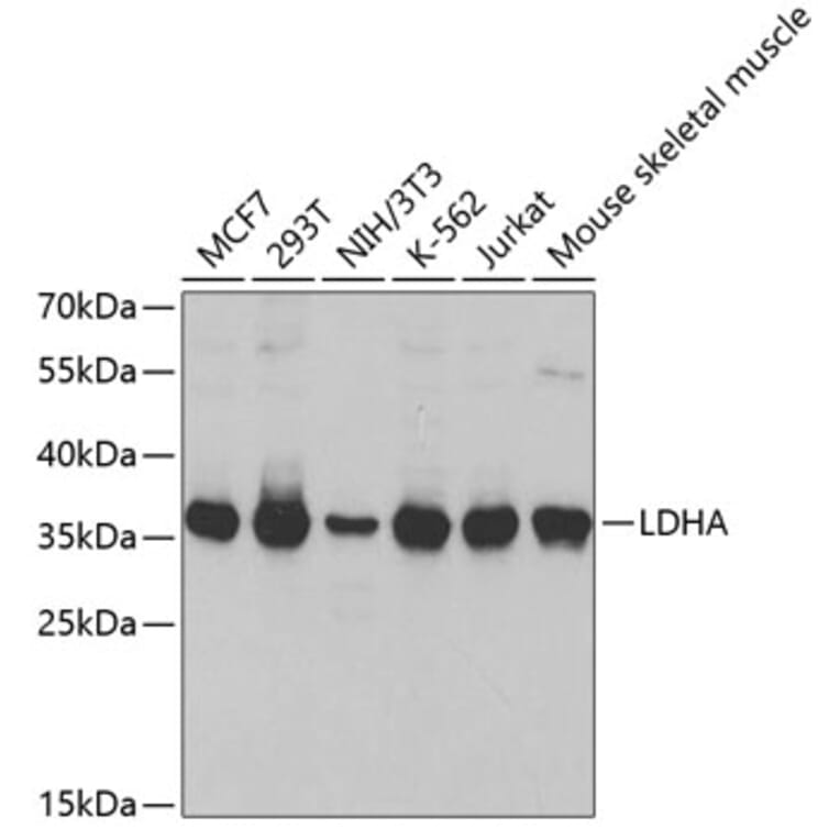 Western Blot - Anti-LDHA Antibody (A1146) - Antibodies.com