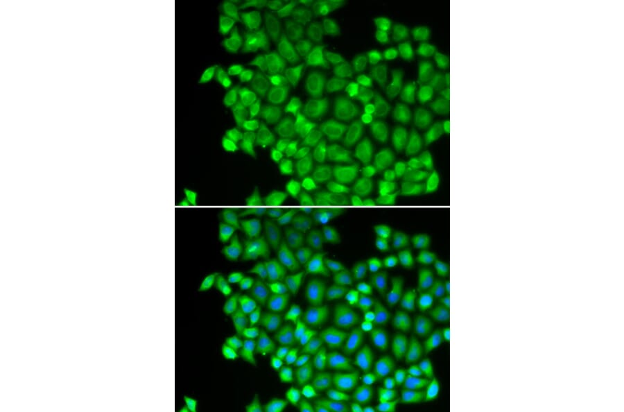 Immunofluorescence - Anti-LDHA Antibody (A1146) - Antibodies.com