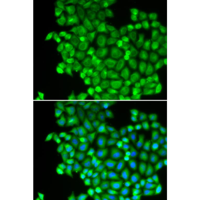 Immunofluorescence - Anti-LDHA Antibody (A1146) - Antibodies.com