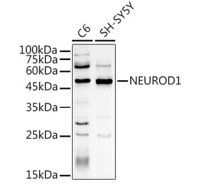 Western Blot - Anti-NeuroD1 Antibody (A13323) - Antibodies.com