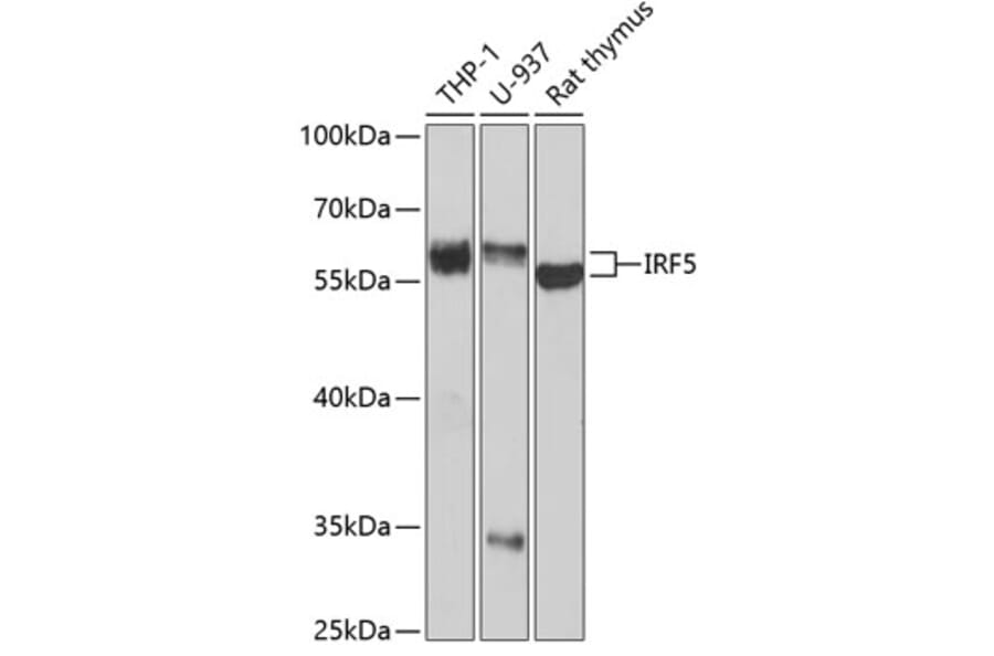 Western Blot - Anti-IRF5 Antibody (A13325) - Antibodies.com