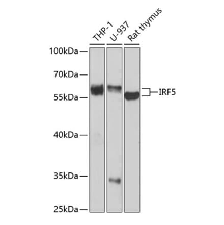 Western Blot - Anti-IRF5 Antibody (A13325) - Antibodies.com