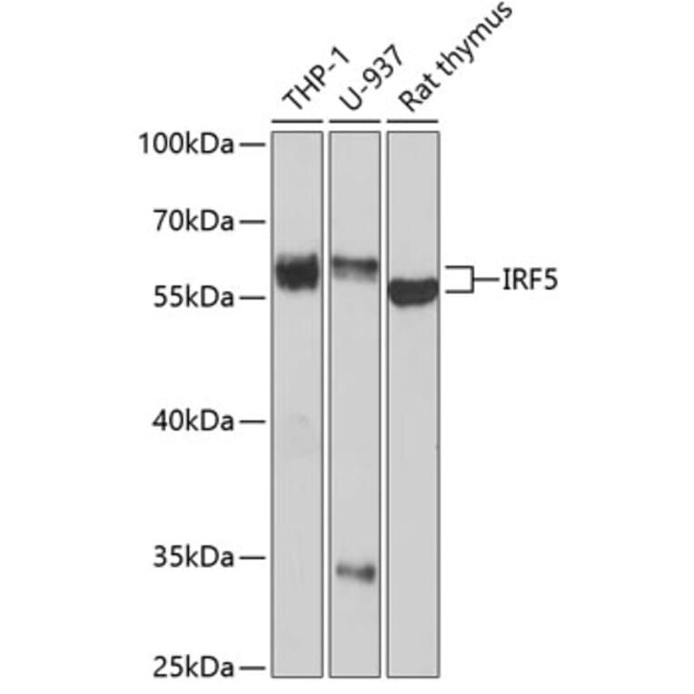 Western Blot - Anti-IRF5 Antibody (A13325) - Antibodies.com