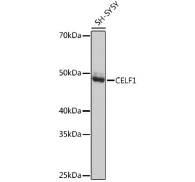 Western Blot - Anti-CUG-BP1 Antibody [ARC1866] (A13326) - Antibodies.com