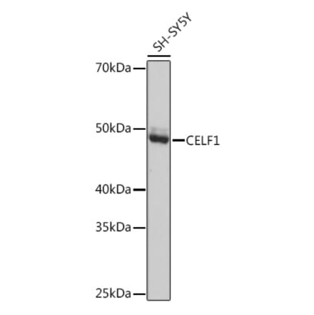 Western Blot - Anti-CUG-BP1 Antibody [ARC1866] (A13326) - Antibodies.com