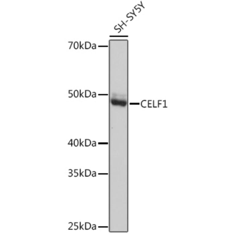 Western Blot - Anti-CUG-BP1 Antibody [ARC1866] (A13326) - Antibodies.com