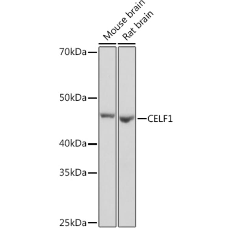 Western Blot - Anti-CUG-BP1 Antibody [ARC1866] (A13326) - Antibodies.com