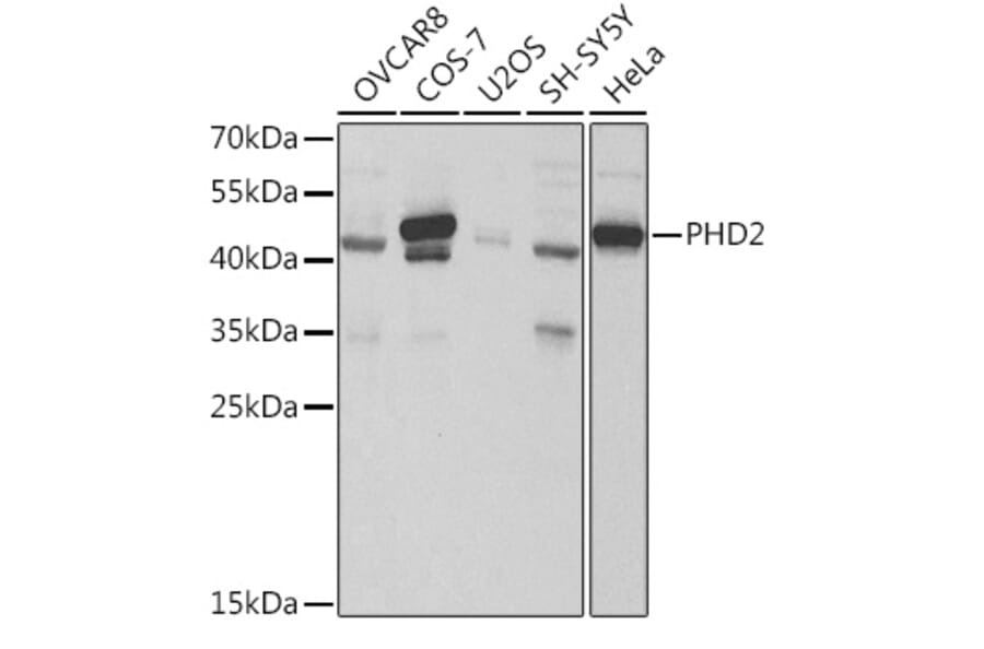 Western Blot - Anti-PHD2/prolyl hydroxylase Antibody (A13327) - Antibodies.com