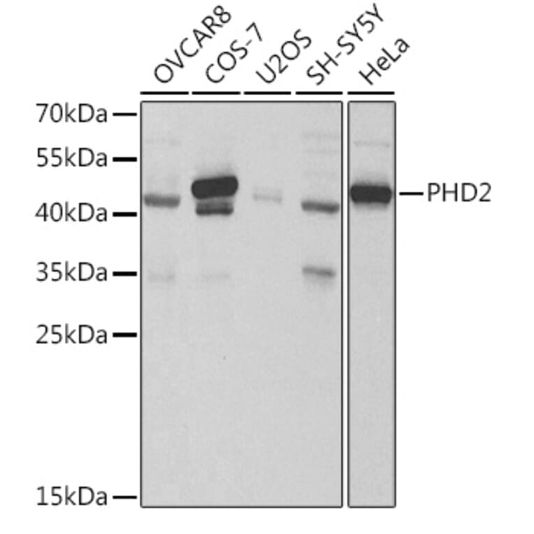 Western Blot - Anti-PHD2/prolyl hydroxylase Antibody (A13327) - Antibodies.com