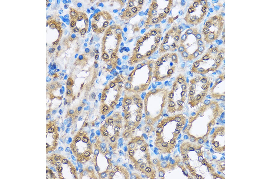Immunohistochemistry - Anti-PHD2/prolyl hydroxylase Antibody (A13327) - Antibodies.com