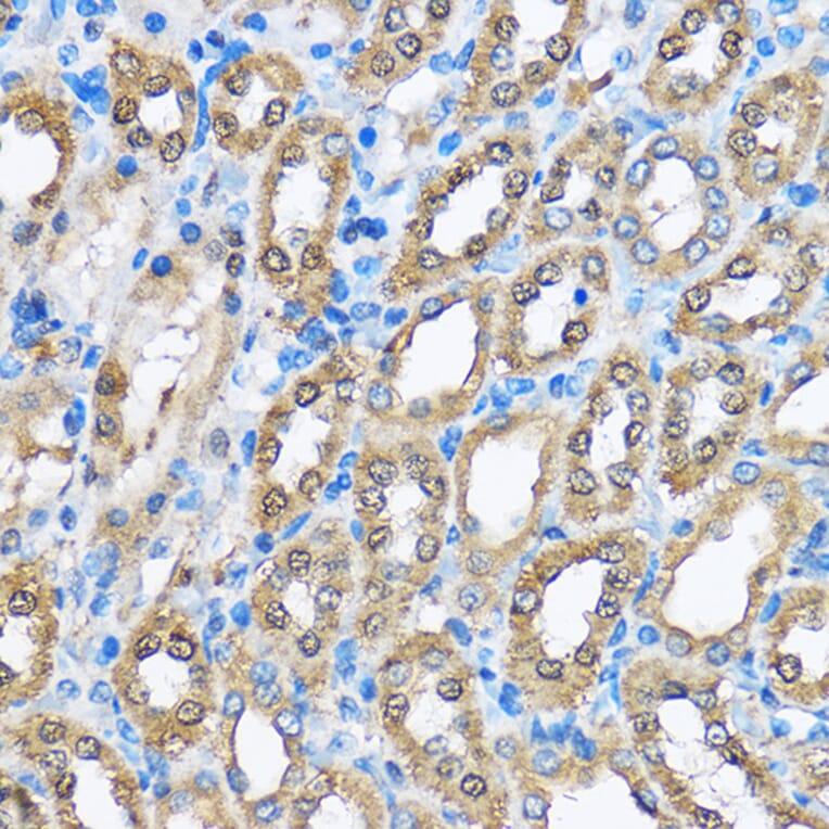 Immunohistochemistry - Anti-PHD2/prolyl hydroxylase Antibody (A13327) - Antibodies.com