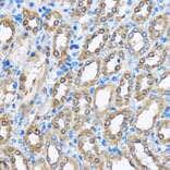 Immunohistochemistry - Anti-PHD2/prolyl hydroxylase Antibody (A13327) - Antibodies.com