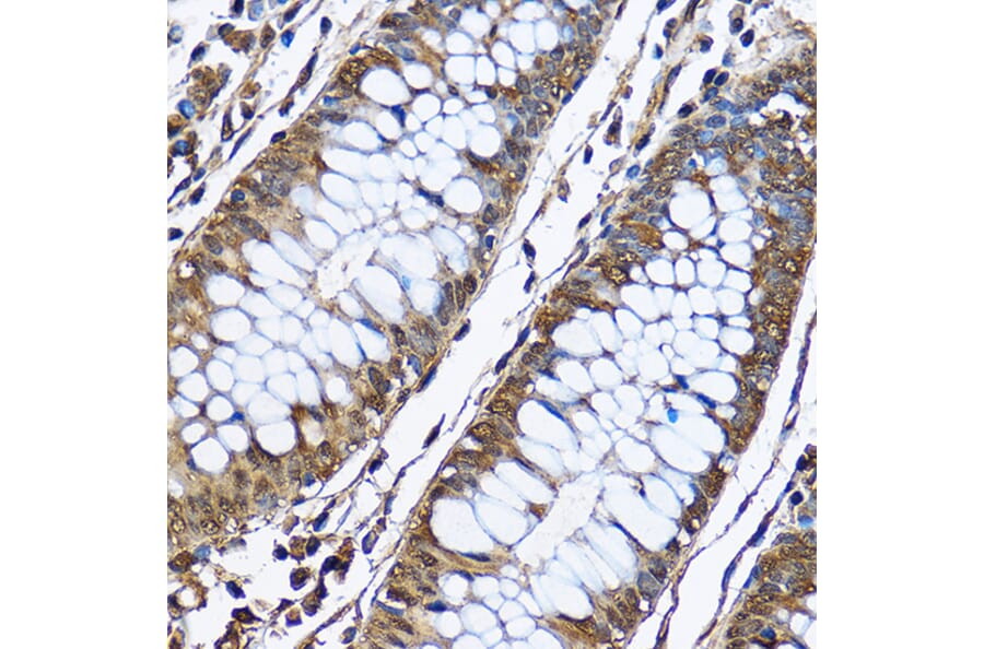 Immunohistochemistry - Anti-PHD2/prolyl hydroxylase Antibody (A13327) - Antibodies.com
