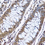 Immunohistochemistry - Anti-PHD2/prolyl hydroxylase Antibody (A13327) - Antibodies.com
