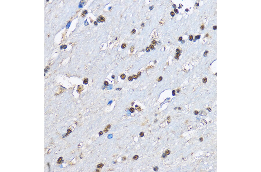 Immunohistochemistry - Anti-PHD2/prolyl hydroxylase Antibody (A13327) - Antibodies.com