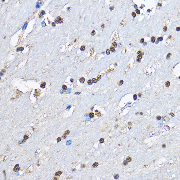Immunohistochemistry - Anti-PHD2/prolyl hydroxylase Antibody (A13327) - Antibodies.com