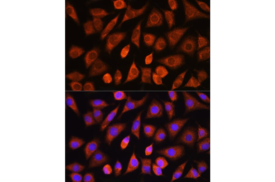 Immunofluorescence - Anti-PHD2/prolyl hydroxylase Antibody (A13327) - Antibodies.com