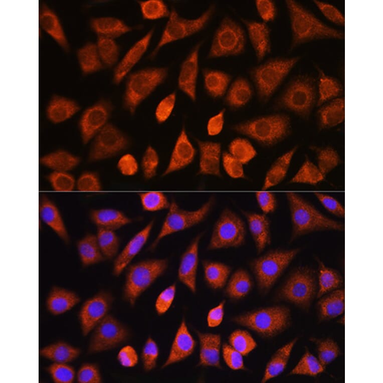 Immunofluorescence - Anti-PHD2/prolyl hydroxylase Antibody (A13327) - Antibodies.com