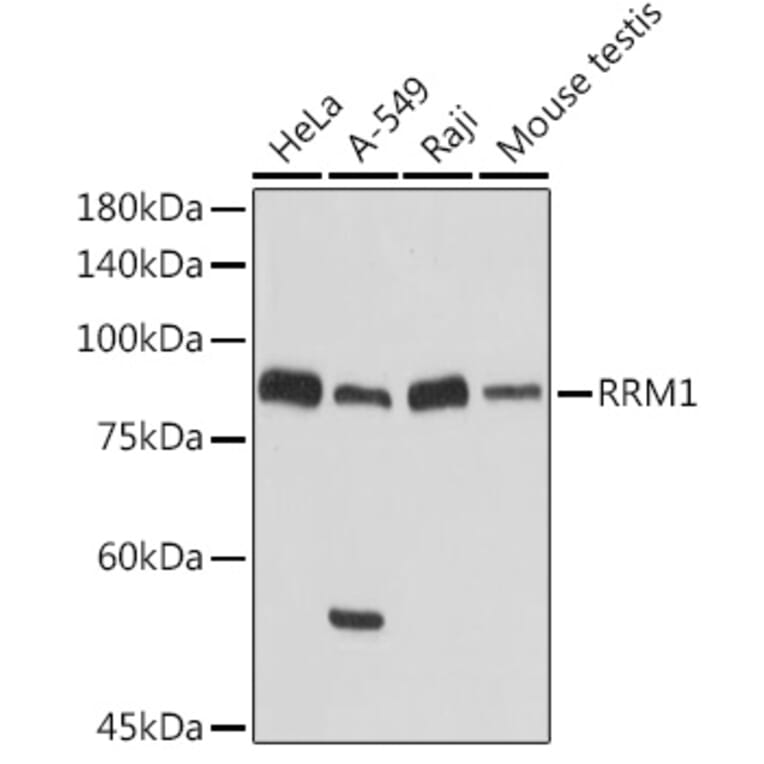 Western Blot - Anti-RRM1 Antibody (A13328) - Antibodies.com