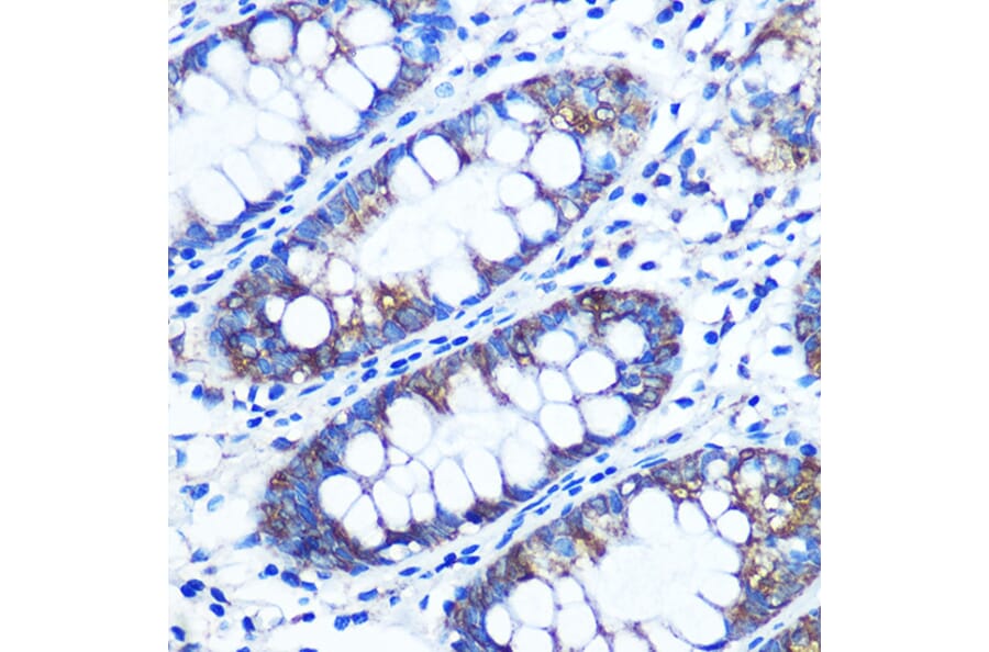 Immunohistochemistry - Anti-RRM1 Antibody (A13328) - Antibodies.com