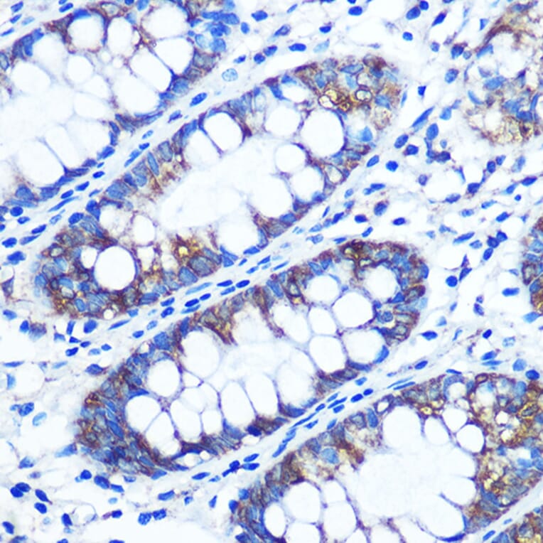 Immunohistochemistry - Anti-RRM1 Antibody (A13328) - Antibodies.com